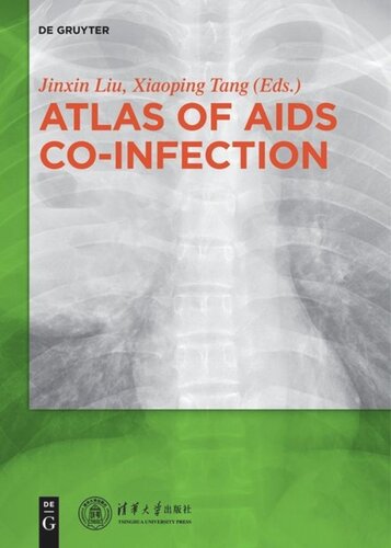 Atlas Of Aids Coinfection Liu Jinxin Editor Tang Xiaoping Editor Zhuang Qiuwan Editor