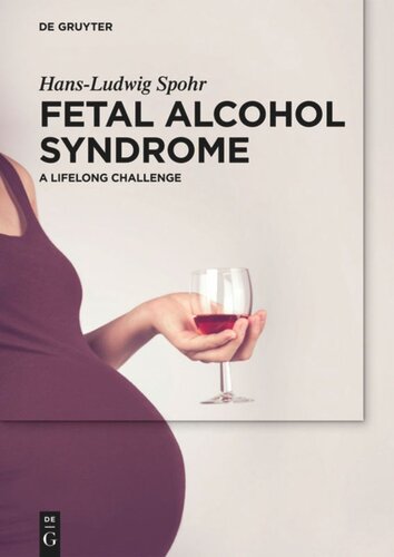 Fetal Alcohol Syndrome A Lifelong Challenge Hansludwig Spohr Gela Becker Manuela Nagel Janpeter Siedentopf Betteke Maria Van Noort Heike Wolter Betteke Maria Van Noort