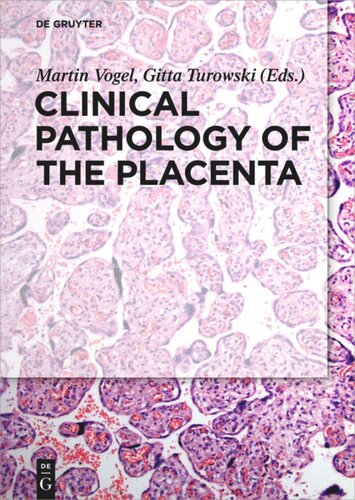 Clinical Pathology Of The Placenta Martin Vogel Editor Gitta Turowski Editor