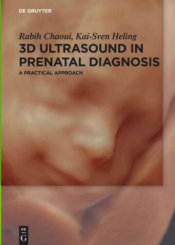 3d Ultrasound In Prenatal Diagnosis A Practical Approach Rabih Chaoui Kaisven Heling