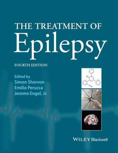 The Treatment Of Epilepsy Simon D Shorvon Emilio Perucca Jerome Engel