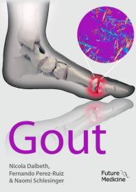 Gout 1st Edition Nicola Dalbeth Fernando Perezruiz Naomi Schlesinger