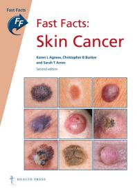 Fast Facts Skin Cancer Skin Cancer 2nd Edition Karen L Agnew Christopher B Bunker Sarah T Arron