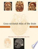Crosssectional Atlas Of The Brain Peter Ratiu Ionflorin Talos