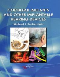 Cochlear Implants And Other Implantable Hearing Devices 1st Edition Michael J Ruckenstein