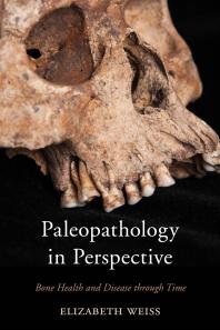 Paleopathology In Perspective Bone Health And Disease Through Time Elizabeth Weiss