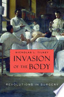 Invasion Of The Body Revolutions In Surgery Nicholas L Tilney