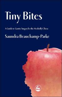 Tiny Bites A Guide To Gastric Surgery For The Morbidly Obese 1st Edition Saundra Beauchampparke Alex M C Macgregor
