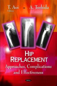 Hip Replacement Approaches Complications And Effectiveness 1st Edition T Aoi A Toshida