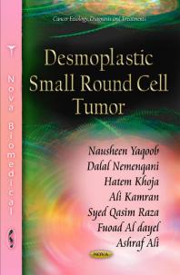 Desmoplastic Small Round Cell Tumor 1st Edition Nausheen Yaqoob Dalal Nemenqani Hatem Khoja Ali Kamran Syed Qasim Raza Fuoad Al Dayel Ashraf Ali