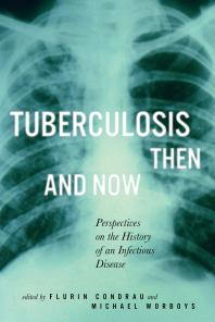 Tuberculosis Then And Now Perspectives On The History Of An Infectious Disease 1st Edition Flurin Condrau Michael Worboys