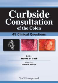 Curbside Consultation Of The Colon 49 Clinical Questions 1st Edition Brooks Cash