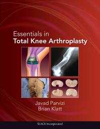 Essentials In Total Knee Arthroplasty 1st Edition Javad Parvizi Brian Klatt