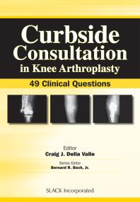 Curbside Consultation In Knee Arthroplasty 49 Clinical Questions 1st Edition Craig Della Valle