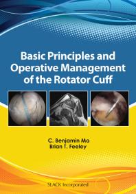 Basic Principles And Operative Management Of The Rotator Cuff 1st Edition Benjamin Ma Brian Feeley