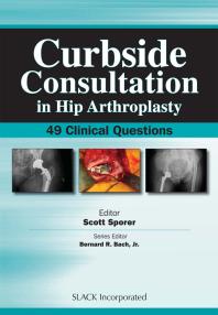 Curbside Consultation In Hip Arthroplasty 49 Clinical Questions 1st Edition Scott Sporer