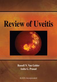 Review Of Uveitis 1st Edition Russell Van Gelder Anita Prasad