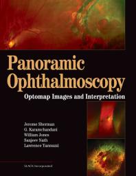 Panoramic Ophthalmoscopy Optomap Images And Interpretation 1st Edition Jerry Sherman Gulshan Karamchandani William Jones Sanjeev Nath