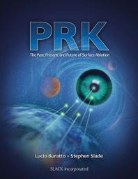Prk The Past Present And Future Of Surface Ablation 1st Edition Lucio Buratto Stephen Slade