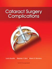 Cataract Surgery Complications 1st Edition Lucio Buratto Stephen F Brint Mario R Romano