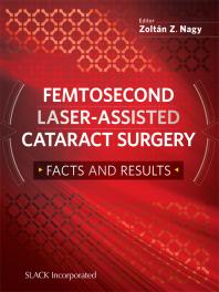Femtosecond Laserassisted Cataract Surgery Facts And Results 1st Edition Zoltan Nagy