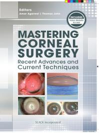 Mastering Corneal Surgery Recent Advances And Current Techniques 1st Edition Amar Agarwal Thomas John