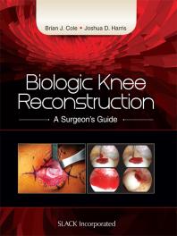 Biologic Knee Reconstruction A Surgeons Guide 1st Edition Brian Cole Joshua Harris