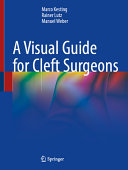 A Visual Guide For Cleft Surgeons Marco Kesting Rainer Lutz Manuel Weber