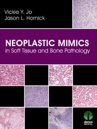 Neoplastic Mimics In Soft Tissue And Bone Pathology 1st Edition Vickie Y Jo Jason L Hornick