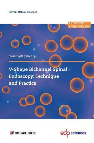 Vshape Bichannel Spinal Endoscopy Technique And Practice Shisheng He