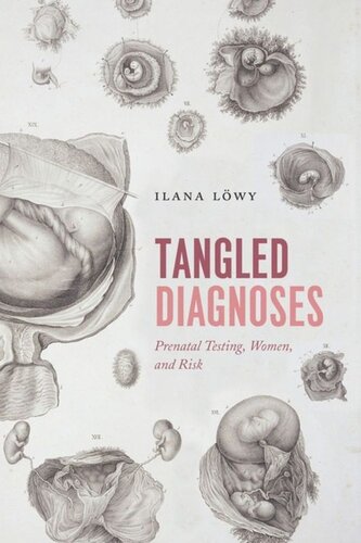 Tangled Diagnoses Prenatal Testing Women And Risk Ilana Lwy