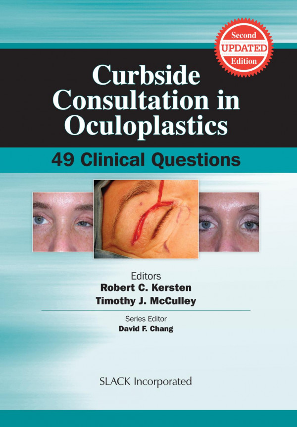 Curbside Consultation In Oculoplastics 49 Clinical Questions Second Edition 1st Edition Robert Kersten Timothy Mcculley