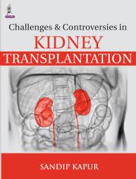 Challenges And Controversies In Kidney Transplantation 1st Edition Sandip Kapur