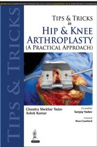 Tips And Tricks In Hip And Knee Arthroplasty 1st Edition Ashok Kumar Sanjay Yadav Chandra Shekhar Yadav
