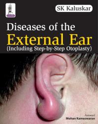 Diseases Of The External Ear Including Stepbystep Otoplasty 1st Edition S K Kaluskar
