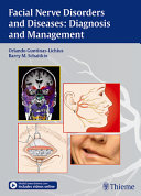 Facial Nerve Disorders And Diseasesdiagnosis And Management Orlando Guntinaslichius