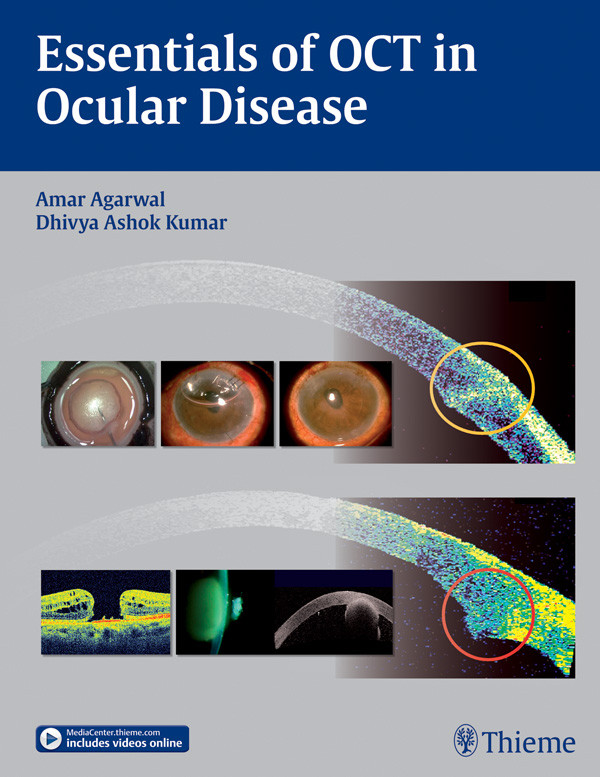 Essentials Of Oct In Ocular Disease Amar Agarwal Ms Frcs Frcophth Dhivya Ashok Kumar Md