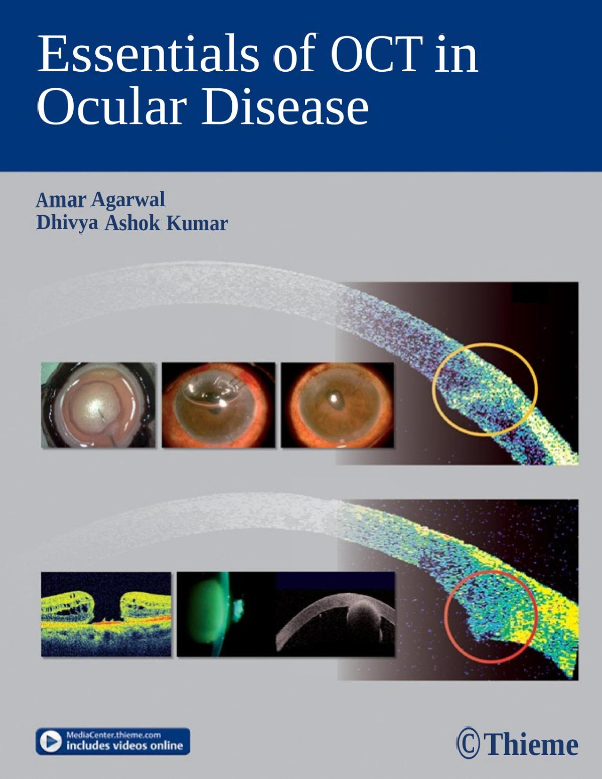 Essentials Of Oct In Ocular Disease Agarwal Amarkumar Dhivya Ashoksteinert