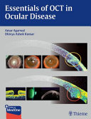 Essentials Of Oct In Ocular Disease Jul 27 20151626230986thieme Amar Agarwal