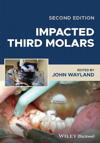 Impacted Third Molars 2nd Edition John Wayland Ed