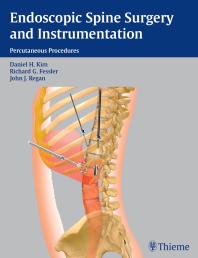 Endoscopic Spine Surgery And Instrumentation 1st Edition Daniel H Kim Richard G Fessler John J Regan