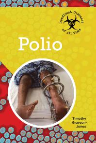 Polio 1st Edition Timothy Graysonjones