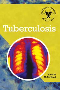 Tuberculosis 1st Edition Randall Mcpartland