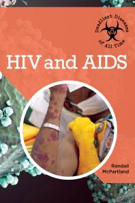Hiv And Aids 1st Edition Randall Mcpartland