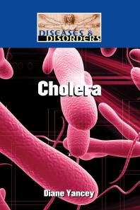 Cholera 1st Edition Diane Yancey