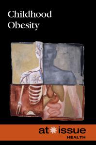 Childhood Obesity 1st Edition Tamara Thompson