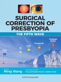 Surgical Correction Of Presbyopia The Fifth Wave 1st Edition Ming Wang