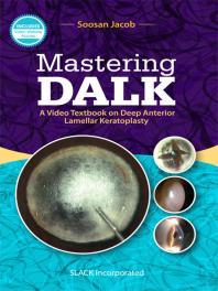 Mastering Dalk A Video Textbook On Deep Anterior Lamellar Keratoplasty 1st Edition Soosan Jacob