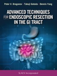 Advanced Techniques For Endoscopic Resection In The Gi Tract 1st Edition Peter Draganov