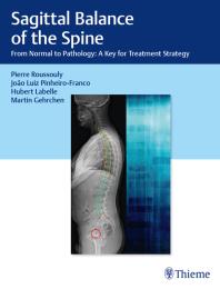 Sagittal Balance Of The Spine From Normal To Pathology A Key For Treatment Strategy 1st Edition Pierre Roussouly Hubert Labelle Joao Luiz Pinheirofranco
